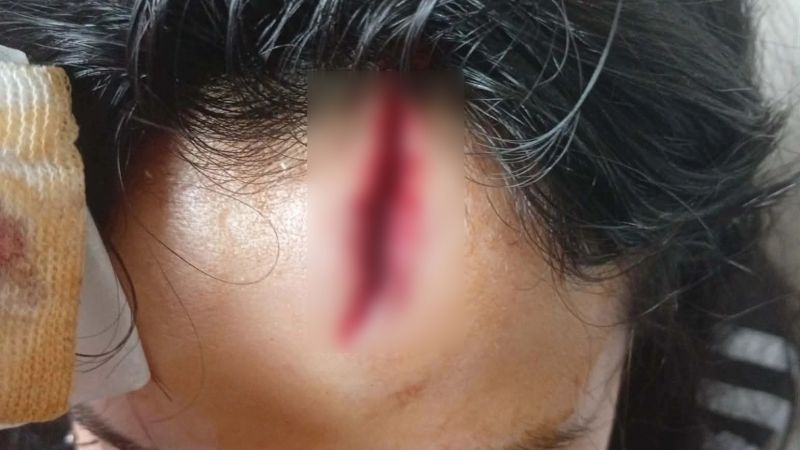 Golpeó a su expareja con un palo en la cabeza: ""Mami, me estoy desangrando"