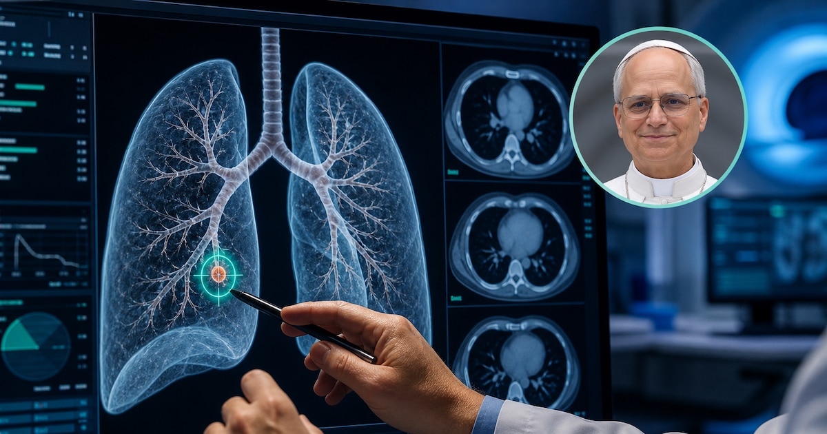Qué es un nódulo pulmonar y cuál sería el pronóstico de la operación del Papa: “Es por prevención”