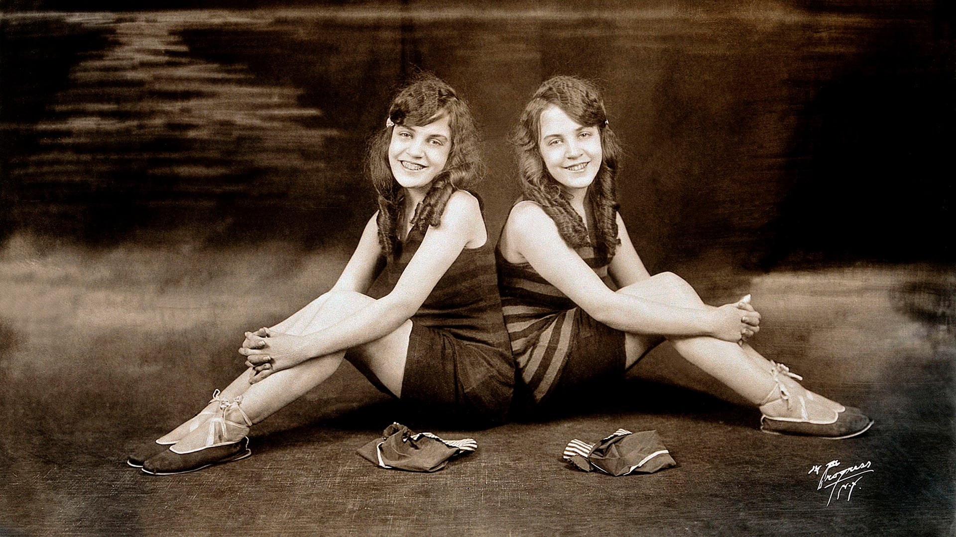 Daisy y Violet Hilton, las gemelas siamesas a las que convirtieron en figuras del espectáculo desde la infancia
