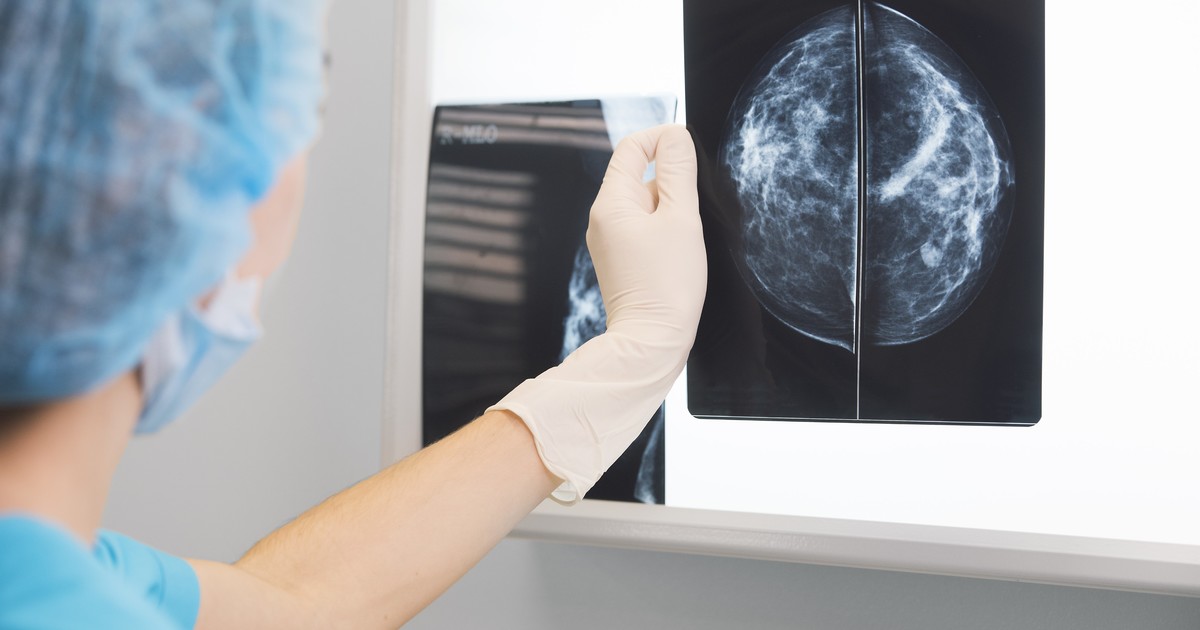 El beneficio 2x1 de la mamografía: qué información da sobre el riesgo cardiovascular
